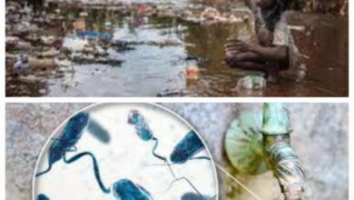 Choléra: manque d’assainissement et l’eau Contaminée