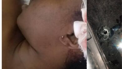 Cayes/Insécurite: Victime d'une balle perdu dans la tête, Cherlande Charles vient de rendre l'âme 4 Cayes/Insécurite: Victime d'une balle perdu dans la tête, Cherlande Charles vient de rendre l'âme