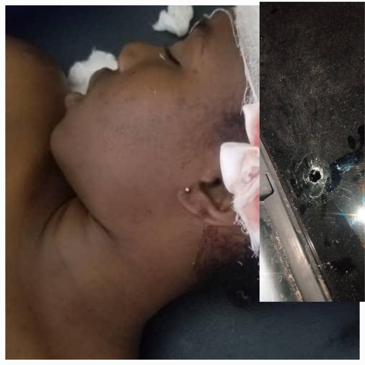 Cayes/Insécurite: Victime d'une balle perdu dans la tête, Cherlande Charles vient de rendre l'âme