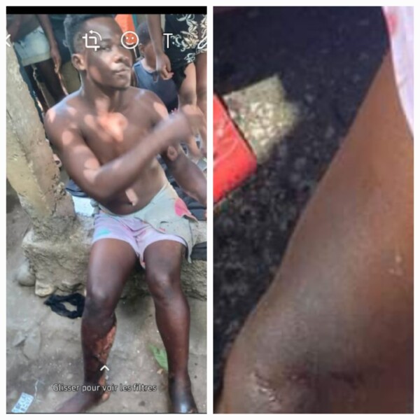 "ZO pa kwit", un présumé bandit issu de Martissant abattu par le commissaire Muscadin
