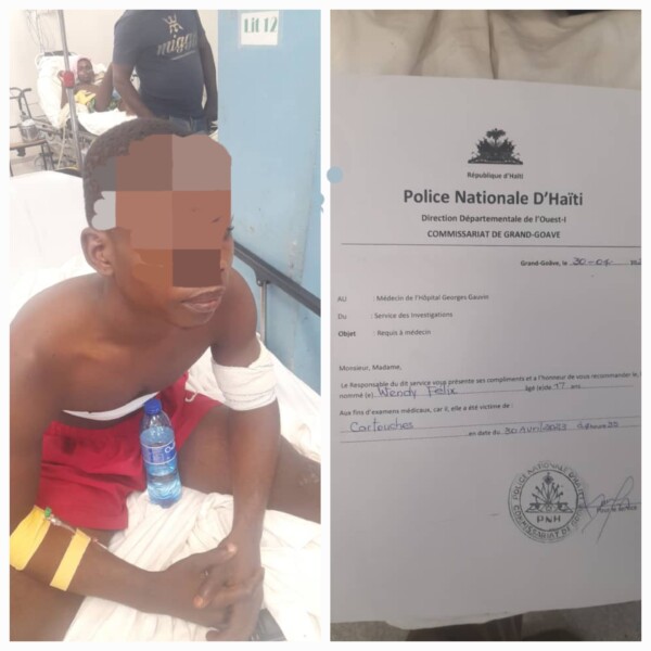 Miragoâne: un jeune de 17 ans blessé par balles, appréhendé puis libéré tout de suite par le commissaire MUSCADIN